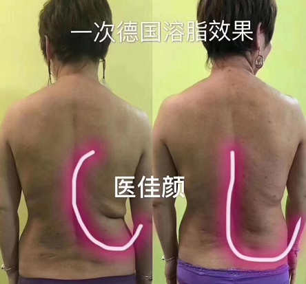 黑科技蛋白溶脂，悦博士·美芬奇·8小时魔力溶脂素