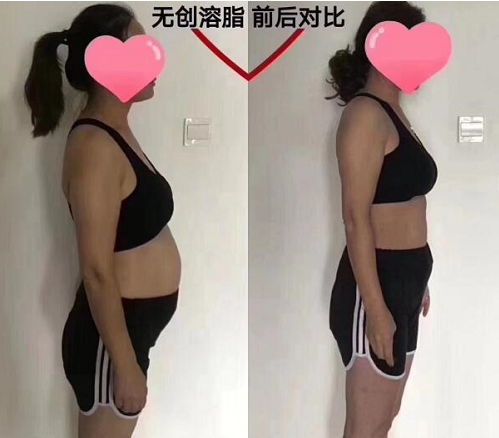 黑科技蛋白溶脂，悦博士·美芬奇·8小时魔力溶脂素